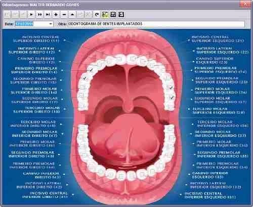 15243803619_D_733086-MLB73669115374_012024-O.jpg blank
